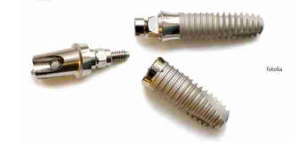 Dentalimplantat